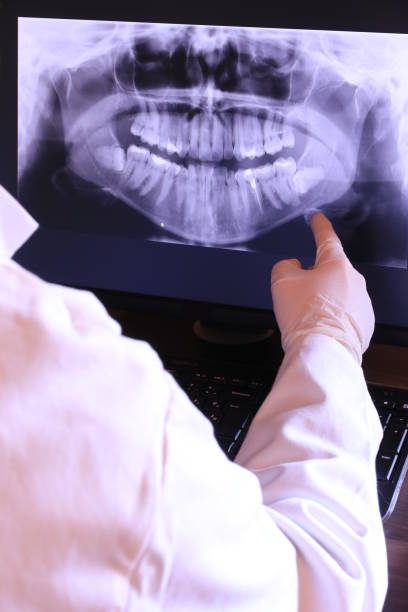 Best Emergency Dental Surgery in River Road, WA